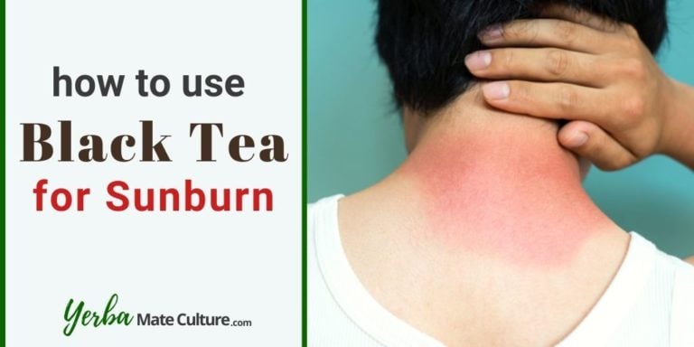 How to Use Black Tea for Sunburn