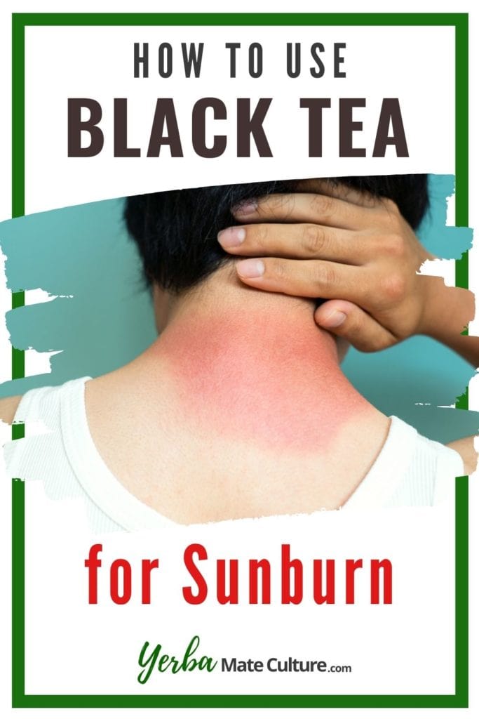 how to use black tea for sunburn pin